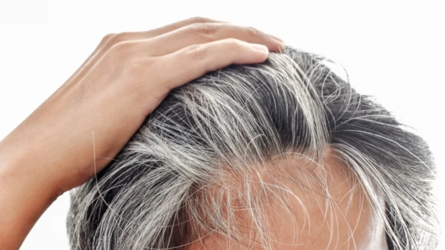 Saçları 14 yaşında beyazladı, araştırdı sebebini buldu